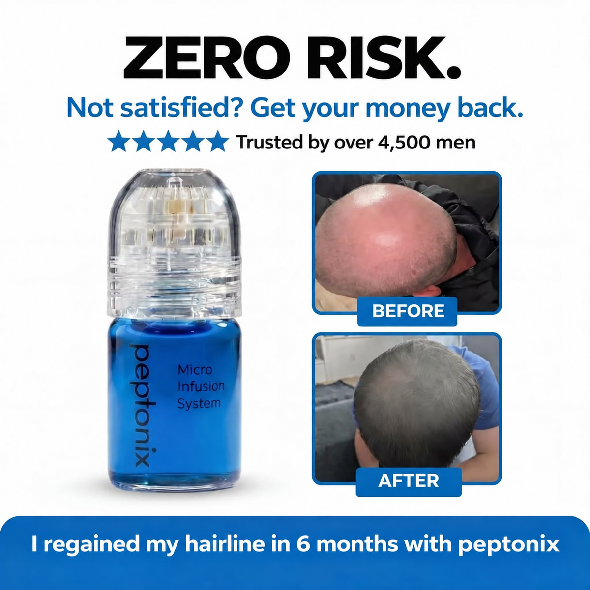 Hair Regrowth System